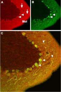 Anti-Ca<sub>V</sub>1.2 (CACNA1C) Antibody