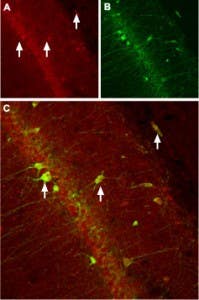Anti-CACNB3 Antibody