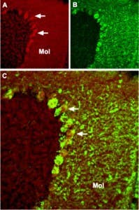 Anti-TRPC4 Antibody