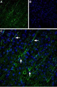 Anti-TRPC5 Antibody