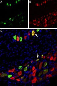 Anti-TRPV1 (VR1) (extracellular)-ATTO Fluor-488 Antibody