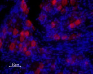 Anti-TRPV1 (VR1) (extracellular) Antibody