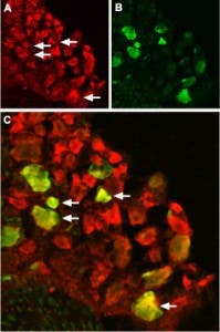 Anti-TRPV1 (VR1) Antibody