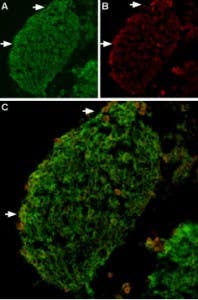 Anti-TRPV2 (VRL1) Antibody