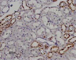 Anti-TRPV5 Antibody