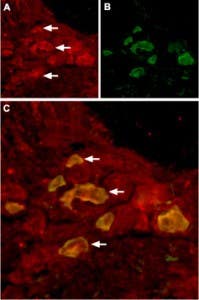 Anti-TRPV6 Antibody