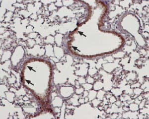 Anti-TRPM4 Antibody