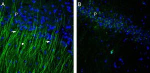 Anti-TRPM6 (extracellular) Antibody