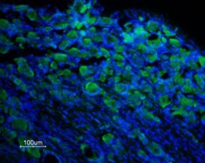 Anti-TRPM8 (extracellular) Antibody