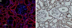 Anti-TRPP1 (PKD2) Antibody