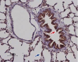Anti-STIM2 Antibody