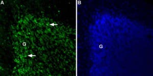 Anti-TPCN2 Antibody
