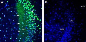 Anti-TRPML1 (Mucolipin 1) Antibody