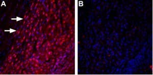 Anti-TRPML3 (Mucolipin 3)-ATTO Fluor-594 Antibody