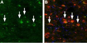 Anti-TRPML3 (Mucolipin 3) Antibody