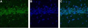 Anti-CALHM1 Antibody