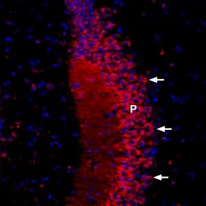 Anti-CACNB2-ATTO Fluor-594 Antibody