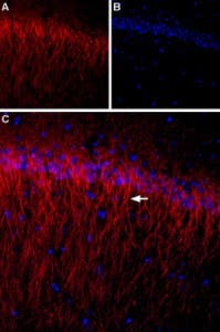 Anti-CACNB1 Antibody