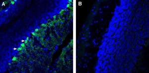 Anti-CACNG7 (extracellular) Antibody