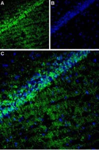 Anti-CACNG8 Antibody
