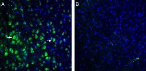 Anti-TRPM7 (extracellular) Antibody