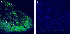 Anti-CALHM2 (extracellular) Antibody