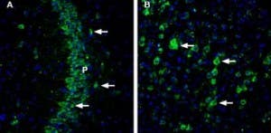 Anti-CHERP Antibody
