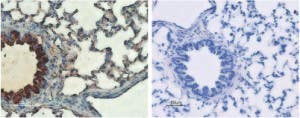Anti-CFTR Antibody