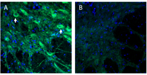 Anti-TMEM16A (ANO1) (extracellular) Antibody