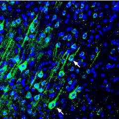 Anti-PMCA4 Antibody