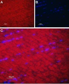 Anti-SERCA1 Antibody