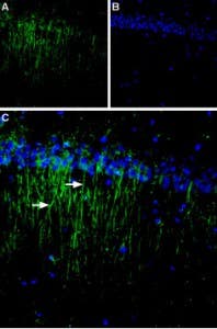 Anti-Calcium Sensing Receptor (extracellular) Antibody