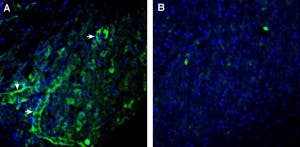 Anti-CCR7 (extracellular) Antibody