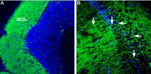 Anti-CRF1/CRHR1 (extracellular) Antibody