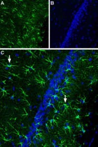 Anti-CNTFRα (extracellular) Antibody