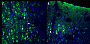 Anti-CX3CL1 (extracellular) Antibody