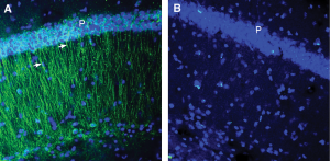 Anti-CCR2 (extracellular) Antibody