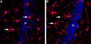 Anti-IBA1/AIF1 Antibody