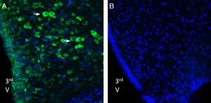 Anti-Nucleobindin-2/Nesfatin-1 Antibody