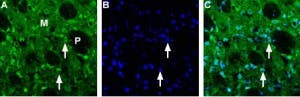 Anti-Choline Transporter (SLC5A7) (extracellular) Antibody