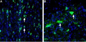 Anti-Vesicular Acetylcholine Transporter (VAChT) Antibody
