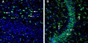 Anti-SLC22A3 (extracellular) Antibody