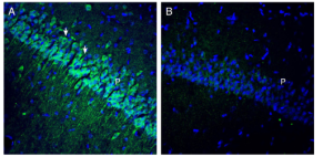 Anti-OCTN1/SLC22A4 Antibody