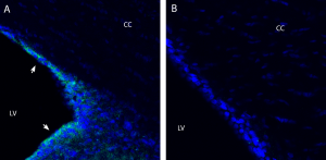 OCTN2/SLC22A5 Blocking Peptide