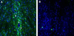 Anti-SLC22A2 (OCT2) Antibody