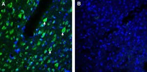 Anti-AXL (extracellular) Antibody