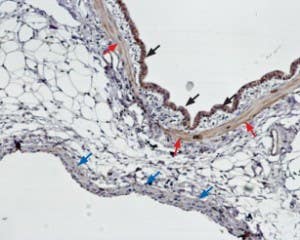 Anti-Endothelin Receptor B Antibody