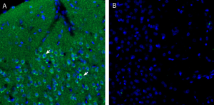 Anti-Endothelin Receptor A (extracellular) Antibody
