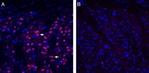 Anti-EphA1 (extracellular) Antibody