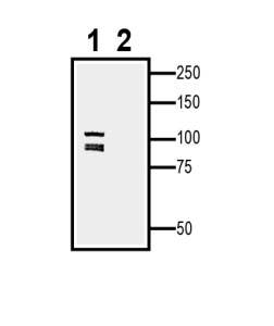 EphA5 (extracellular) Blocking Peptide